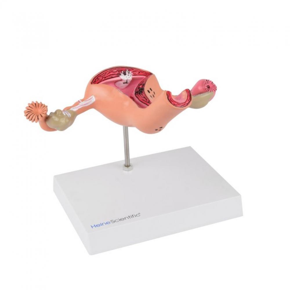 HeineScientific | Uterus-Modell (H139069)