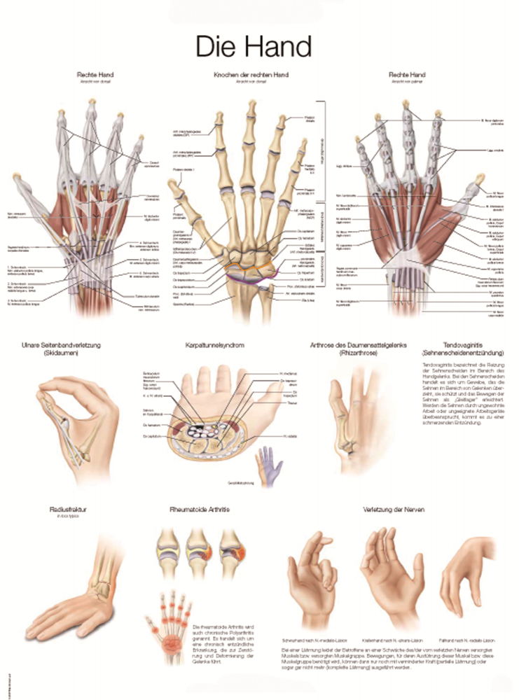 Erler-Zimmer | Lehrtafel Hand (AL129)