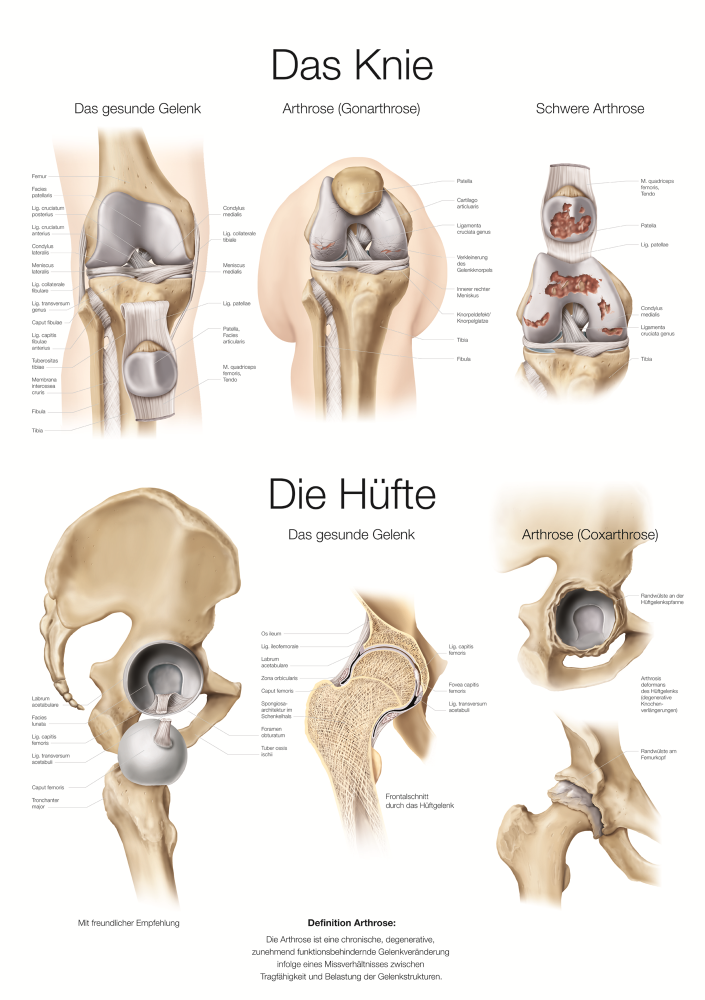 Erler-Zimmer | Lehrtafel Knie & Hüfte (AL151)